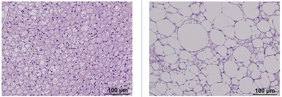 h and e stained adipose tissue from lean and obese mice