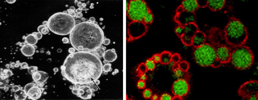 images of perilipin associated with lipid droplets