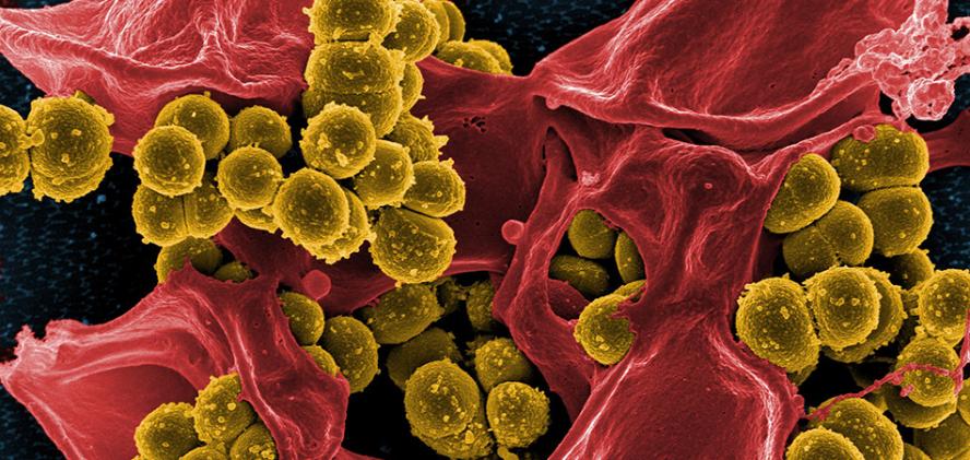 bacteria killins a cell