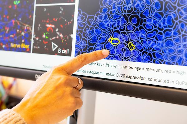 Cell image enlarged on computer screen