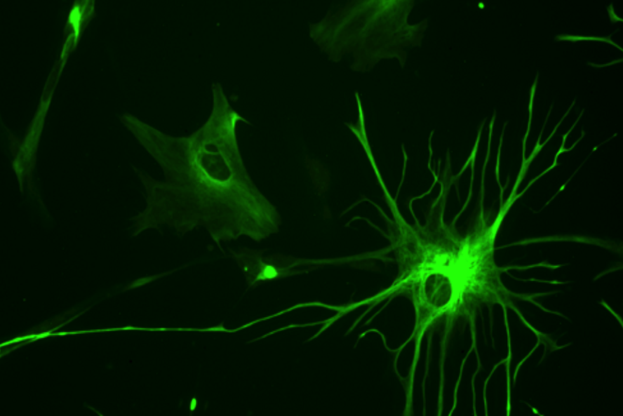 Human astrocyte depicted in neon green