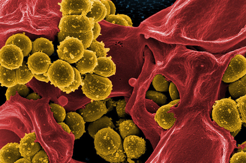 bacteria killins a cell