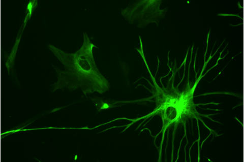 Human astrocyte depicted in neon green